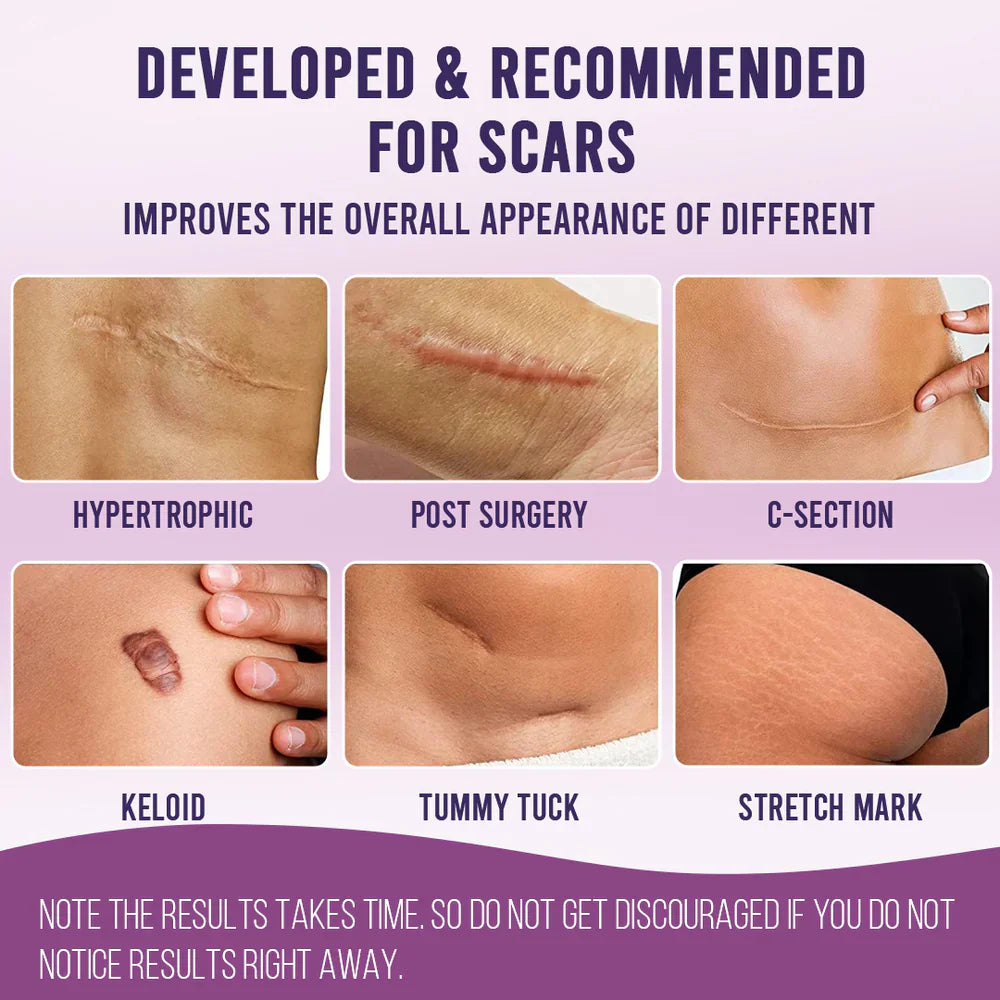 Scar Free Skin Tape - Smooth Skin, Scar-Free Confidence