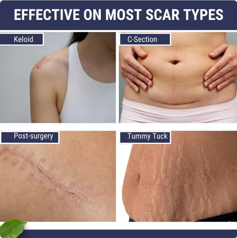Scar Free Skin Tape - Smooth Skin, Scar-Free Confidence