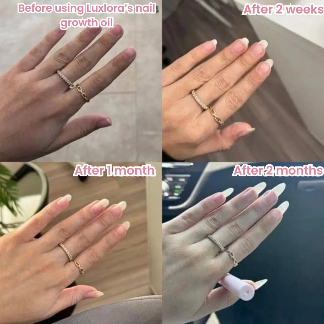 Nails Growth Oil | Cuticle Oil