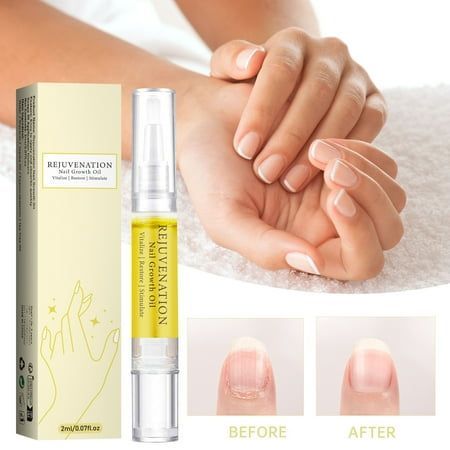 Nails Growth Oil | Cuticle Oil