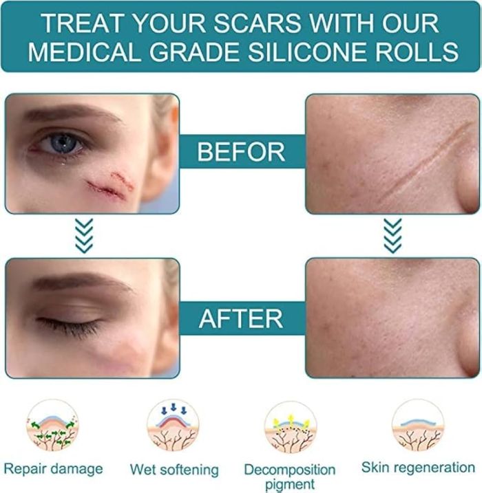 Scar Free Skin Tape - Smooth Skin, Scar-Free Confidence