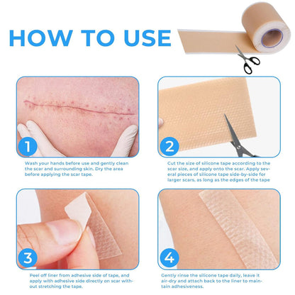 Scar Free Skin Tape - Smooth Skin, Scar-Free Confidence