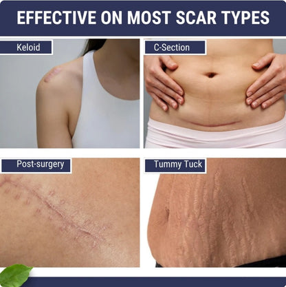 Scar Free Skin Tape - Smooth Skin, Scar-Free Confidence