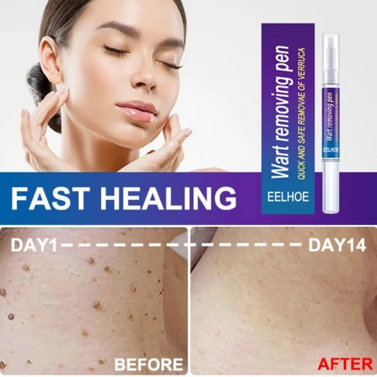 Wart Removal Mole Remedy Liquid Pen