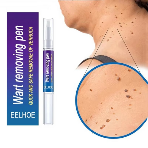 Wart Removal Mole Remedy Liquid Pen