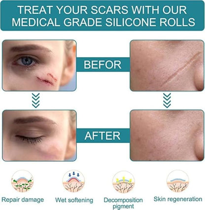 Scar Free Skin Tape - Smooth Skin, Scar-Free Confidence